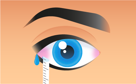 Diagnóstico ojo seco